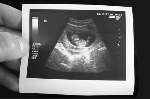 Bills currently being considered in the Texas Legislature would require pregnant women to receive and be shown a sonogram of their unborn child, listen to its heartbeat and hear a description of the fetus. The bills will resume discussion this week. 